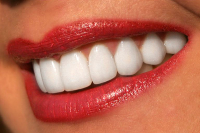 otbelivanie-zubov-v-krasnodare